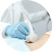 超音波検査器(エコー)