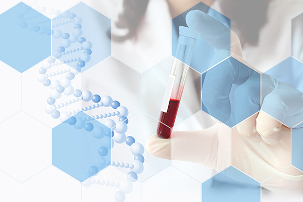 血液検査（甲状腺ホルモン測定）